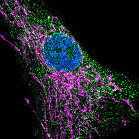 Image microscopique d’un fibroblaste de peau. Le récepteur IP3R3 est marqué en vert, les mitochondries en magenta et le noyau en bleu © Unité Inserm 1109, Université de Strasbourg