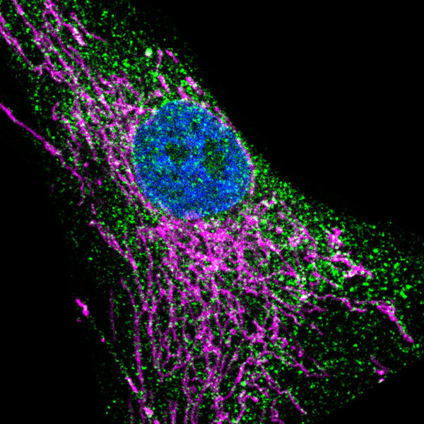 Image microscopique d’un fibroblaste de peau. Le récepteur IP3R3 est marqué en vert, les mitochondries en magenta et le noyau en bleu © Unité Inserm 1109, Université de Strasbourg