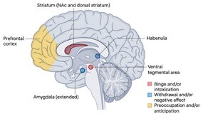 Structures cérébrales impliquées dans les troubles de l'usage d'opiacés