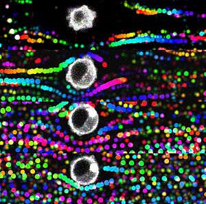 Des cellules tumorales (blanc) et leur environment microfluidique sont explorées à l’aide de billes fluorescents©G Follain N Osmani S Harlepp - INSERM U 1109/Unistra