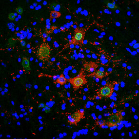 Image d'immunofluorescence dans la moëlle épinière d'une souris SLA. Crédit Sylvie Grosch