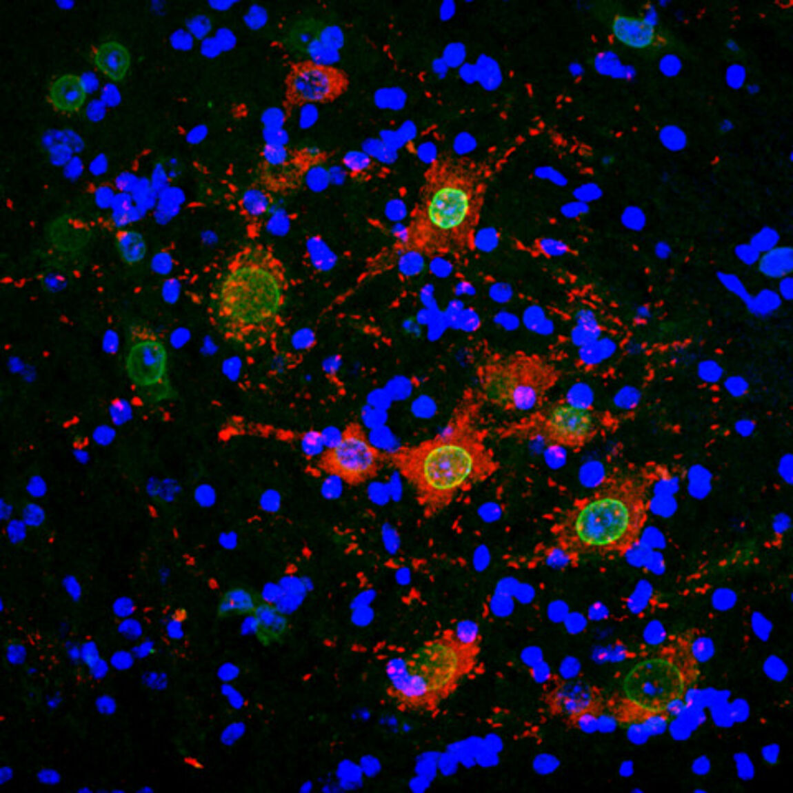 Image d'immunofluorescence dans la moëlle épinière d'une souris SLA. Crédit Sylvie Grosch