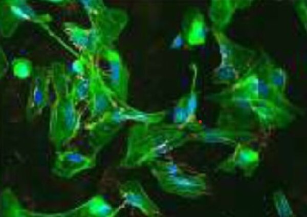 Representative IF images of FN and ColI matrix assembly by MES cells after treatment with soluble TNC©U 1109 