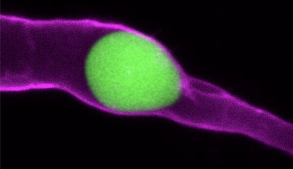 Une bille en polyacrylamide (vert), façonnée pour mimer une cellule tumorale, est ici coincée dans un vaisseau sanguin (violet). ©V.Gensbittel, J.Goetz