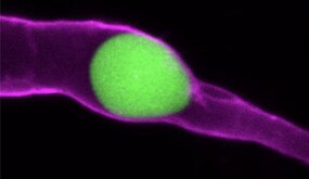 Une bille en polyacrylamide (vert), façonnée pour mimer une cellule tumorale, est ici coincée dans un vaisseau sanguin (violet). ©V.Gensbittel, J.Goetz