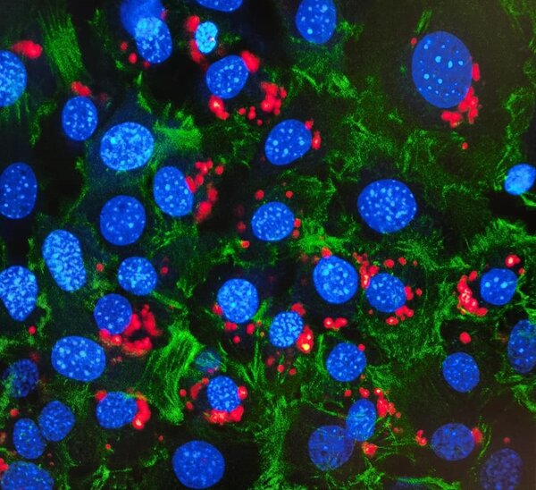 Hydrogels d’acide hyaluronique antibactériens, anti-inflammatoires et capables de délivrer les acides nucléiques ©Varvara Gribova - Inserm 1121/Unistra