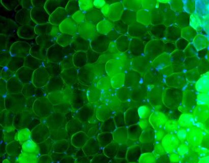 Tissu adipeux viscéral de souris marqué en fluorescence avec de l’AdipoRed. Les noyaux sont colorés en bleu. © Vincent Marion.