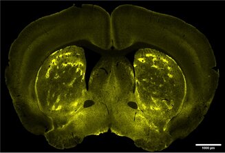 CRBS U1114 Récepteur de la morphine dans le cerveau ©B. Kieffer et collaborateurs
