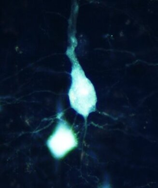 CRBS U1118 Upper motor neurons ©C. Marques & C. Rouaux