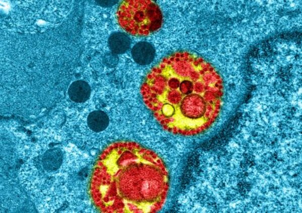 Covid-19 Observation intracellulaire d’épithélium respiratoire humain reconstitué MucilAir™ infecté par le SARS-CoV-2. © Manuel Rosa-Calatrava, Inserm