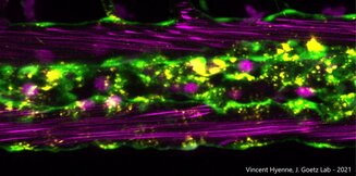 U1109 Confocal Microscopy of tumor - 2021 @V. Hyenne 