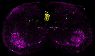 CRBS U1118 Lower motor neurons ©J. Scekic-Zahirovic & C. Rouaux