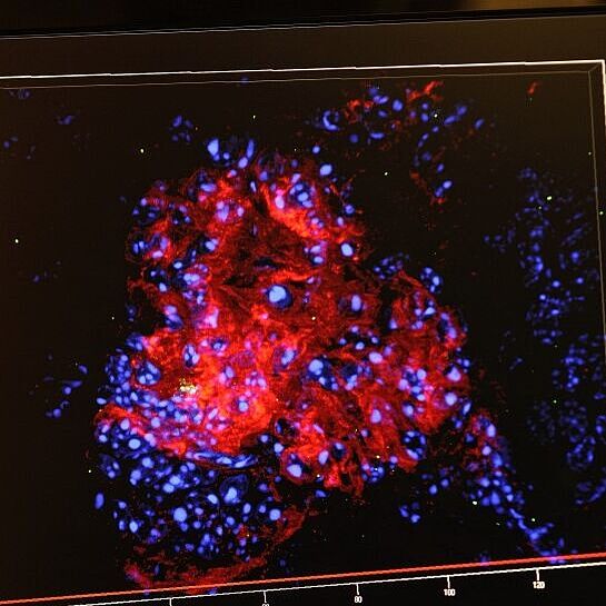 CRBS U1112 Vue 3D de la proteine pro-inflammatoire STAT3 dans le rein (souris) ©P. Delapierre