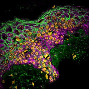 Human skin - healthy tissue