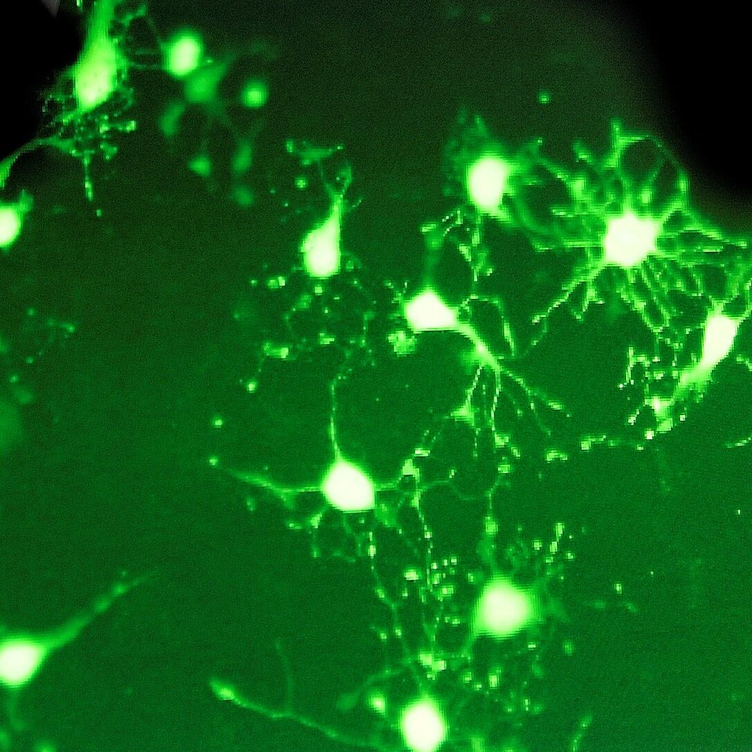 CRBS U 1119 Oligodendrocytes synthétisant de la myéline ©P. Delapierre