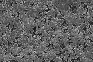  Inserm U1121 : The crystalline structures of a calcium silicate dental sealer @N. Kharouf
