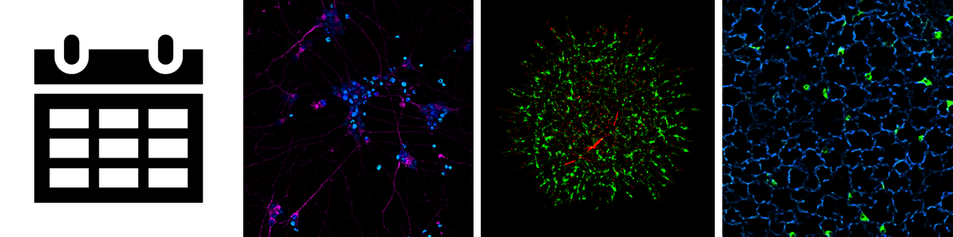 CRBS PIC-STRA réservations © Pascal Kessler