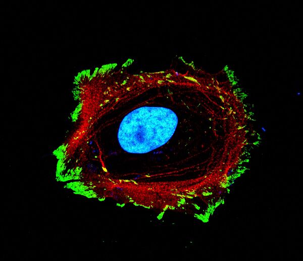 Les cellules adhèrent à leur environnement grâce au modelage de la chromatine et les relais mécaniques (en bleu : la chromatine, en rouge : le cytosquelette, en vert : les protéines d’adhésion ) © Morgane Rabineau, unité 1121 Inserm/Unistra