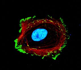 Les cellules adhèrent à leur environnement grâce au modelage de la chromatine et les relais mécaniques (en bleu : la chromatine, en rouge : le cytosquelette, en vert : les protéines d’adhésion ) © Morgane Rabineau, unité 1121 Inserm/Unistra