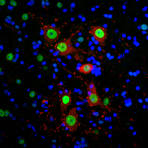 Image d'immunofluorescence dans la moëlle épinière d'une souris sauvage. Crédit Sylvie Grosch
